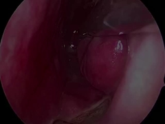 Eenmalige ultra-kleine en flexibele neurologische sonde PLA407