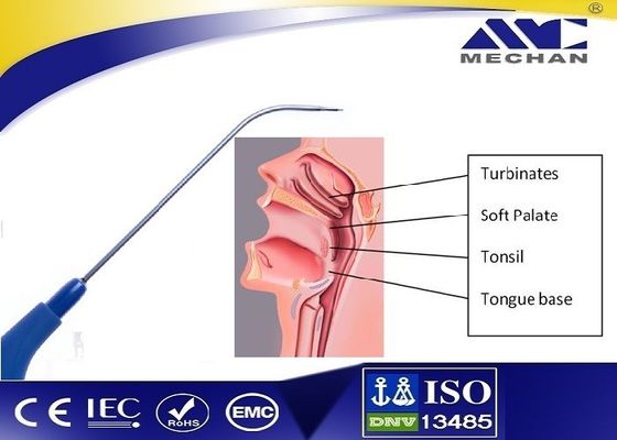ENT Sonde van het Mechanplasma voor Tubinate Channeling en Ablatie